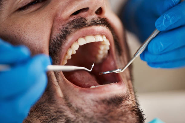 Best Emergency Dental Care for Broken or Chipped Teeth in David City, NE